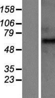 Western Blot: GABA A Receptor beta 2 Overexpression Lysate (Adult Normal) [NBP2-06504] Left-Empty vector transfected control cell lysate (HEK293 cell lysate); Right -Over-expression Lysate for GABA A Receptor beta 2.