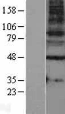 Western Blot: GABA A Receptor gamma 1 Overexpression Lysate (Adult Normal) [NBL1-10925] Left-Empty vector transfected control cell lysate (HEK293 cell lysate); Right -Over-expression Lysate for GABA A Receptor gamma 1.