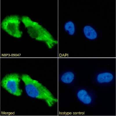 Immunocytochemistry/Immunofluorescence: GABA-AR alpha 1 Antibody (1F4) - Chimeric [NBP3-09047] - Immunofluorescence analysis of paraformaldehyde fixed U251 cells on Shi-fix(TM) coverslips stained with the chimeric rabbit IgG version of 1F4 (NBP3-09047) at 10 ug/ml for 1h followed by Alexa Fluor(R) 488 secondary antibody (2 ug/ml), showing membrane staining. The nuclear stain is DAPI (blue). Panels show from left-right, top-bottom NBP3-09047, DAPI, merged channels and an isotype control. The isotype control was an unknown specificity antibody followed by staining with Alexa Fluor(R) 488 secondary antibody.