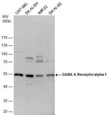 Western Blot GABA-AR alpha 1 Antibody