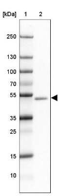 Western Blot: GABA-AR alpha 1 Antibody [NBP2-33762] - Lane 1: Marker  [kDa] 250, 130, 100, 70, 55, 35, 25, 15, 10.  Lane 2: Cerebral Cortex