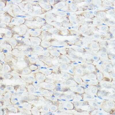 Immunohistochemistry-Paraffin: GABA-AR alpha 2 Antibody [NBP3-02985] - Immunohistochemistry of paraffin-embedded mouse stomach using GABA-AR alpha 2 Rabbit pAb (NBP3-02985) at dilution of 1:250 (40x lens). Perform high pressure antigen retrieval with 10 mM citrate buffer pH 6.0 before commencing with IHC staining protocol.