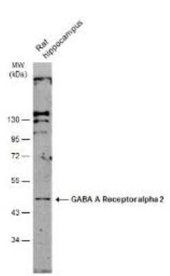 Western Blot: GABA-AR alpha 2 Antibody [NBP2-16566] - Rat tissue extract (50 ug) was separated by 10% SDS-PAGE, and the membrane was blotted with GABA A Receptor alpha 2 antibody [N1C2] diluted at 1:500. The HRP-conjugated anti-rabbit IgG antibody was used to detect the primary antibody.