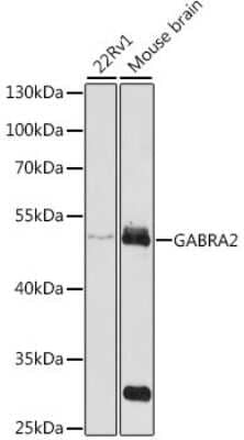 Western Blot: GABA-AR alpha 2 Antibody [NBP3-02985] - Analysis of extracts of various cell lines, using GABA-AR alpha 2 antibody at 1:1000 dilution. Secondary antibody: HRP Goat Anti-Rabbit IgG (H+L) at 1:10000 dilution. Lysates/proteins: 25ug per lane. Blocking buffer: 3% nonfat dry milk in TBST. Detection:Basic ECL Kit