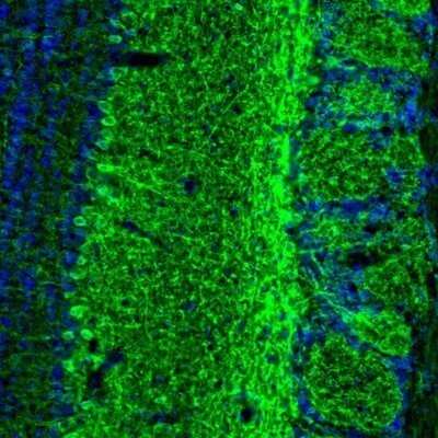 Immunohistochemistry: GABA-AR alpha 3 Antibody [NBP1-87499] - Staining of mouse olfactory bulb shows labelling of both neurons and synapses.