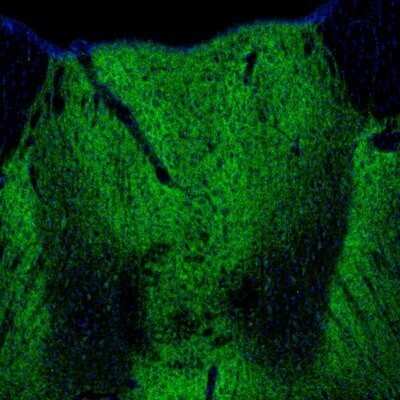 Immunohistochemistry: GABA-AR alpha 3 Antibody [NBP1-87499] - Staining of mouse thalamus shows strong positivity in the paraventricular thalamic nucleus.