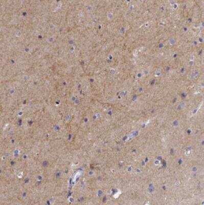 Immunohistochemistry-Paraffin: GABA-AR alpha 3 Antibody [NBP1-87499] - Staining of human cerebral cortex shows moderate positivity in neuronal processes in neuropil.