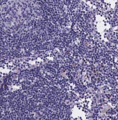 Immunohistochemistry-Paraffin: GABA-AR alpha 3 Antibody [NBP1-87499] - Staining of human lymph node shows no positivity in non-germinal center cells as expected.