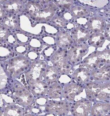 Immunohistochemistry-Paraffin: GABA-AR alpha 3 Antibody [NBP1-87499] - Staining of human lymph node shows no positivity in non-germinal center cells as expected.