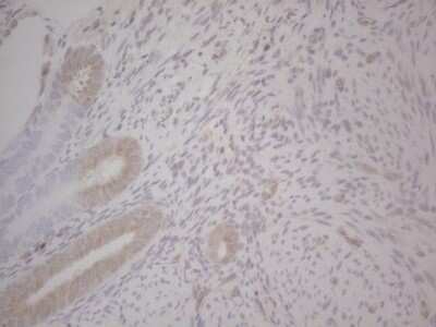 Immunohistochemistry: GABA-AR alpha 5 Antibody (OTI1G9) - Azide and BSA Free [NBP2-70789] - Analysis of Human endometrium tissue. (Heat-induced epitope retrieval by Tris-EDTA, pH8.0)