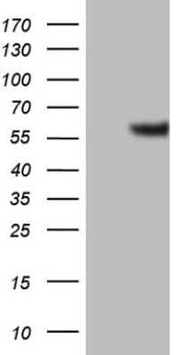 Western Blot: GABA-AR alpha 5 Antibody (OTI1G9) - Azide and BSA Free [NBP2-70789] - Analysis of HEK293T cells were transfected with the pCMV6-ENTRY control (Left lane) or pCMV6-ENTRY GABA-A R alpha 5.