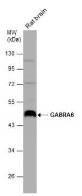 Western Blot: GABA-AR alpha 6 Antibody [NBP3-12973] - Rat tissue extract (50 ug) was separated by 10% SDS-PAGE, and the membrane was blotted with GABRA6 antibody (NBP3-12973) diluted at 1:1000.