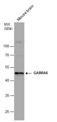 Western Blot: GABA-AR alpha 6 Antibody [NBP3-12973] - Mouse tissue extract (50 ug) was separated by 10% SDS-PAGE, and the membrane was blotted with GABRA6 antibody (NBP3-12973) diluted at 1:1000.