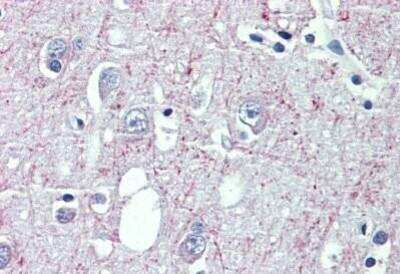 Immunohistochemistry-Paraffin: GABA-B R1 Antibody [NBP1-52389] - Analysis of anti-GABBR1 antibody with human brain, cortex at concentration 3.75 ug/ml.