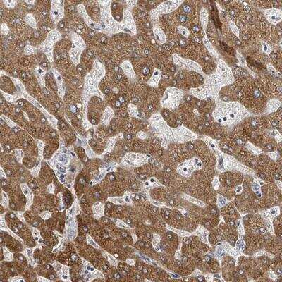 Immunohistochemistry-Paraffin: GABA-B R1 Antibody [NBP2-14033] -  Staining of human liver shows strong cytoplasmic positivity in hepatocytes.