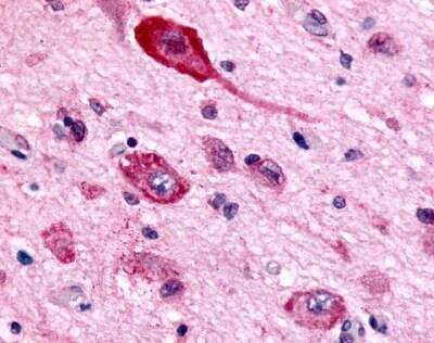 Immunohistochemistry-Paraffin: GABA-B R1 Antibody [NLS5332] - GABA B Receptor 1 Antibody [NLS5332] - IHC analysis of Brain, Neurons and glia using NLS5332 at 7 ug/ ml.