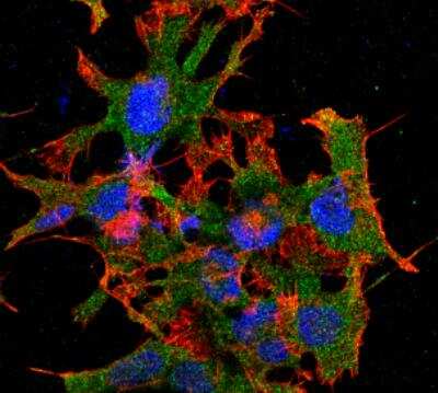 Immunocytochemistry/Immunofluorescence: GABA-B R1 Antibody (S93A-49) [NBP2-59336] - Tissue: Neuroblastoma cell line SK-N-BE. Species: Human. Fixation: 4% Formaldehyde for 15 min at RT. Primary Antibody: Mouse Anti-GABA-B Receptor 1 Monoclonal Antibody at 1:100 for 60 min at RT. Secondary Antibody: Goat Anti-Mouse ATTO 488 at 1:100 for 60 min at RT. Counterstain: Phalloidin Texas Red F-Actin stain; DAPI (blue) nuclear stain at 1:1000, 1:5000 for 60min RT, 5min RT. Localization: Cell Membrane. Magnification: 60X.