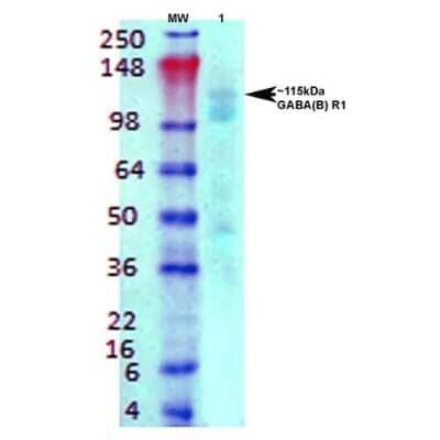 Western Blot: GABA-B R1 Antibody (S93A-49) [NBP2-59336] - Western Blot analysis of Rat brain membrane lysate showing detection of GABA-B R1 protein using Mouse Anti-GABA-B R1 Monoclonal Antibody, Clone S93A-49 (NBP2-59336). Primary Antibody: Mouse Anti-GABA-B R1 Monoclonal Antibody (NBP2-59336) at 1:1000.