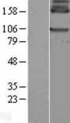 Western Blot: GABA B Receptor 1 Overexpression Lysate (Adult Normal) [NBL1-10908] Left-Empty vector transfected control cell lysate (HEK293 cell lysate); Right -Over-expression Lysate for GABA B Receptor 1.