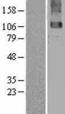 Western Blot GABA-B R2 Overexpression Lysate