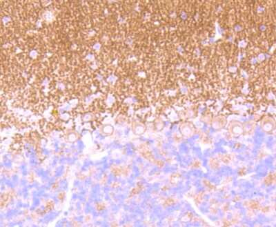 Immunohistochemistry-Paraffin: GABA B Receptor Compounds Antibody (JU31-32) [NBP2-75496] - Analysis of paraffin-embedded mouse cerebellum tissue using anti- GABA B Receptor 2 antibody. Counter stained with hematoxylin.
