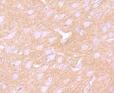 Immunohistochemistry-Paraffin: GABA B Receptor Compounds Antibody (JU31-32) [NBP2-75496] - Analysis of paraffin-embedded rat brain tissue using anti- GABA B Receptor 2 antibody. Counter stained with hematoxylin.