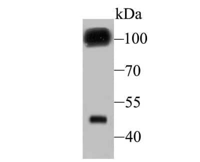 Western Blot: GABA B Receptor Compounds Antibody (JU31-32) [NBP2-75496] - Analysis of GABA B Receptor 2 on mouse cerebellum tissue lysate using anti- GABA B Receptor 2 antibody at 1/500 dilution.