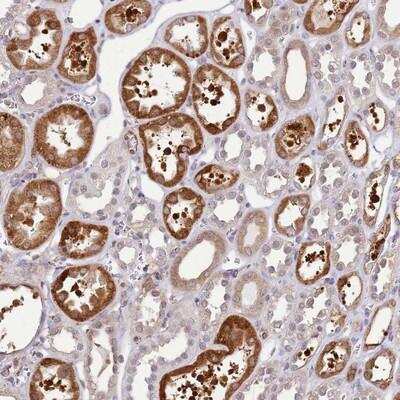 Immunohistochemistry-Paraffin GABA Receptor Epsilon Antibody - BSA Free