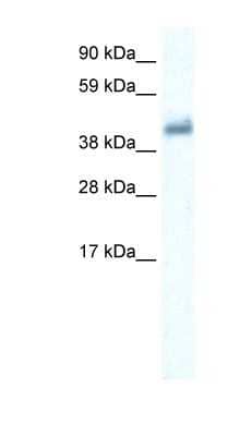 Western Blot: GABA Receptor Epsilon Antibody [NBP1-80081] - Human Placenta lysate, concentration 0.2-1 ug/ml.