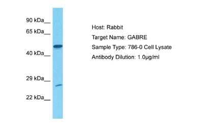 Western Blot GABA Receptor Epsilon Antibody - BSA Free