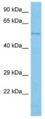 Western Blot: GABA Transporter 2 Antibody [NBP3-10073] - Western blot analysis of GABA Transporter 2 in Human PC-3 Whole Cell lysates. Antibody dilution at 1ug/ml