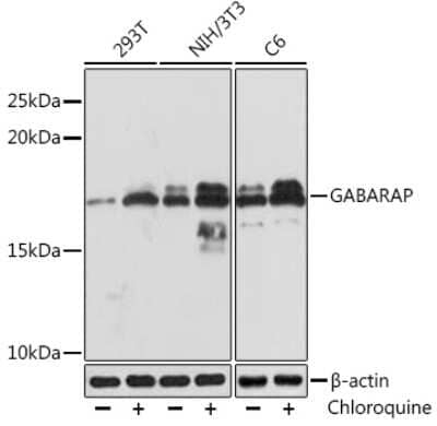 Western Blot: GABARAP Antibody (5T6W5) [NBP3-16376] - Western blot analysis of extracts of various cell lines, using GABARAP Rabbit mAb (NBP3-16376) at 1:1000 dilution.293T cells were treated by Chloroquine (50 uM) at 37C for 20 hours. Secondary antibody: HRP Goat Anti-Rabbit IgG (H+L) at 1:10000 dilution. Lysates/proteins: 25ug per lane. Blocking buffer: 3% BSA. Detection: ECL Basic Kit. Exposure time: 10s.