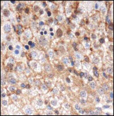 Immunohistochemistry GABARAP Antibody - BSA Free