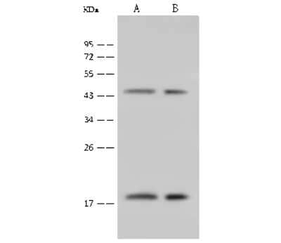 Western Blot: GABARAP Antibody [NBP2-99474] - Anti-GABARAP rabbit polyclonal antibody at 1:500 dilution. Lane A: SH-SY5Y Whole Cell Lysate Lane B: HepG2 Whole Cell Lysate Lysates/proteins at 30 ug per lane. Secondary Goat Anti-Rabbit IgG (H+L)/HRP at 1/10000 dilution. Developed using the ECL technique. Performed under reducing conditions. Predicted band size: 14 kDa