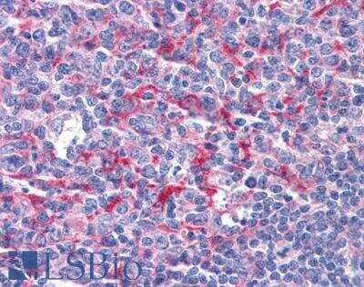 Immunohistochemistry-Paraffin GABPB1 Antibody