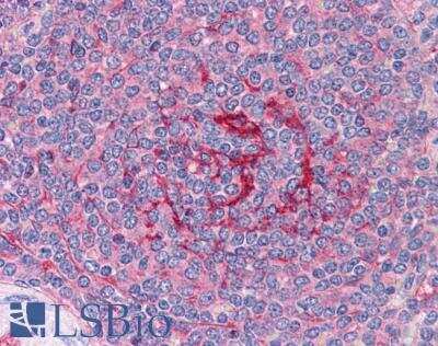 Immunohistochemistry-Paraffin GABPB1 Antibody