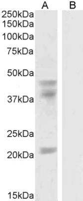 Western Blot GABPB1 Antibody