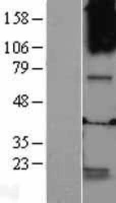 Western Blot: GABRQ Overexpression Lysate (Adult Normal) [NBL1-10931] Left-Empty vector transfected control cell lysate (HEK293 cell lysate); Right -Over-expression Lysate for GABRQ.