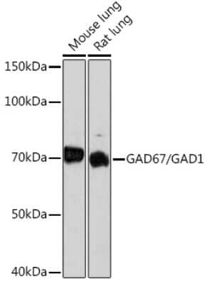 Western Blot: GAD1/GAD67 Antibody (4I8S8) [NBP3-15480] - Western blot analysis of extracts of various cell lines, using GAD1/GAD67 Rabbit mAb (NBP3-15480) at 1:1000 dilution. Secondary antibody: HRP Goat Anti-Rabbit IgG (H+L) at 1:10000 dilution. Lysates/proteins: 25ug per lane. Blocking buffer: 3% nonfat dry milk in TBST. Detection: ECL Basic Kit. Exposure time: 3min.
