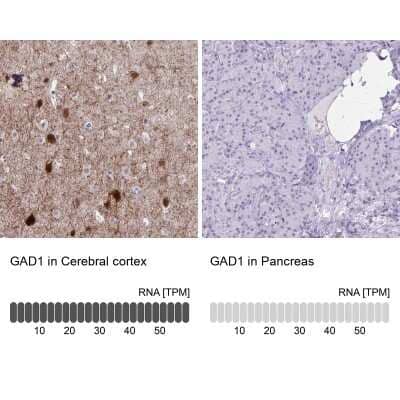 Immunohistochemistry-Paraffin: GAD1/GAD67 Antibody [NBP2-34113] - Analysis in human cerebral cortex and pancreas tissues. Corresponding GAD1 RNA-seq data are presented for the same tissues.