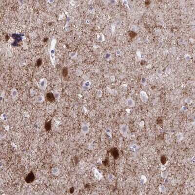Immunohistochemistry-Paraffin: GAD1/GAD67 Antibody [NBP2-34113] - Staining of human cerebral cortex shows  strong positivity in neurons.