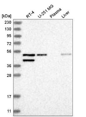 Western Blot: GAD1/GAD67 Antibody [NBP2-58132] - Western blot analysis in human cell line RT-4, human cell line U-251 MG, human plasma and human liver tissue.