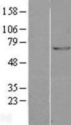 Western Blot: GAD1/GAD67 Overexpression Lysate (Adult Normal) [NBL1-10933] Left-Empty vector transfected control cell lysate (HEK293 cell lysate); Right -Over-expression Lysate for GAD1/GAD67.