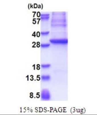 SDS-Page: Recombinant Human GAD1/GAD67 Protein [NBP2-51655] -  15% SDS Page (3 ug)