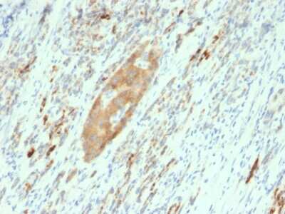 Immunohistochemistry-Paraffin: GAD2/GAD65 Antibody (GAD2/2362) [NBP3-08704] - Formalin-fixed, paraffin-embedded human Pancreas stained with GAD2/GAD65 Mouse Monoclonal Antibody (GAD2/2362).