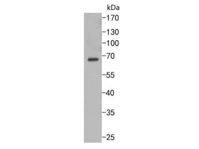 Western Blot: GAD65/67 Antibody (JM11-11) [NBP2-66855] - Western blot analysis of GAD67 on SH-SY5Y cells lysates using anti-GAD67 antibody at 1/500 dilution.