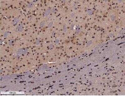 Immunohistochemistry-Paraffin: GADD153/CHOP Antibody (9C8) - Azide and BSA Free [NBP2-80745] - FFPE tissue section of mouse brain using 1:100 dilution of GADD153/CHOP antibody. The signal was developed using HRP-DAB based detection method which followed counterstaining of the nuclei with hematoxylin. The antibody generated a cytoplasmic and nuclear