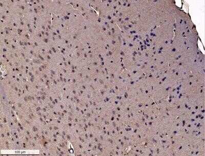 Immunohistochemistry-Paraffin: GADD153/CHOP Antibody (9C8) - Azide and BSA Free [NBP2-80745] - FFPE tissue section of mouse brain using 1:100 dilution of GADD153/CHOP antibody. The signal was developed using HRP-DAB based detection method which followed counterstaining of the nuclei with hematoxylin. The antibody generated a cytoplasmic and nuclear