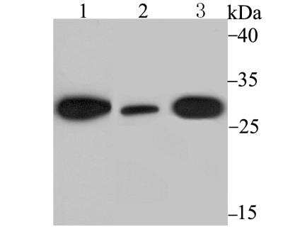 Western Blot: GADD153/CHOP Antibody [NBP2-76926] - Western blot analysis of DDIT3 on different lysates using anti-DDIT3 antibody at 1/500 dilution.Positive control:Lane1: Mouse testis tissueLane2: LOVOLane3: Mouse brain tissue