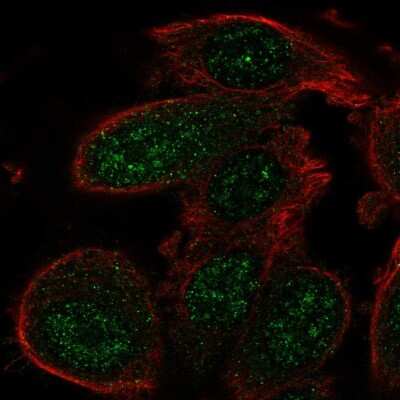 Immunocytochemistry/Immunofluorescence: GADD45 alpha Antibody [NBP2-55059] - Staining of human cell line PC-3 shows localization to nuclear speckles.